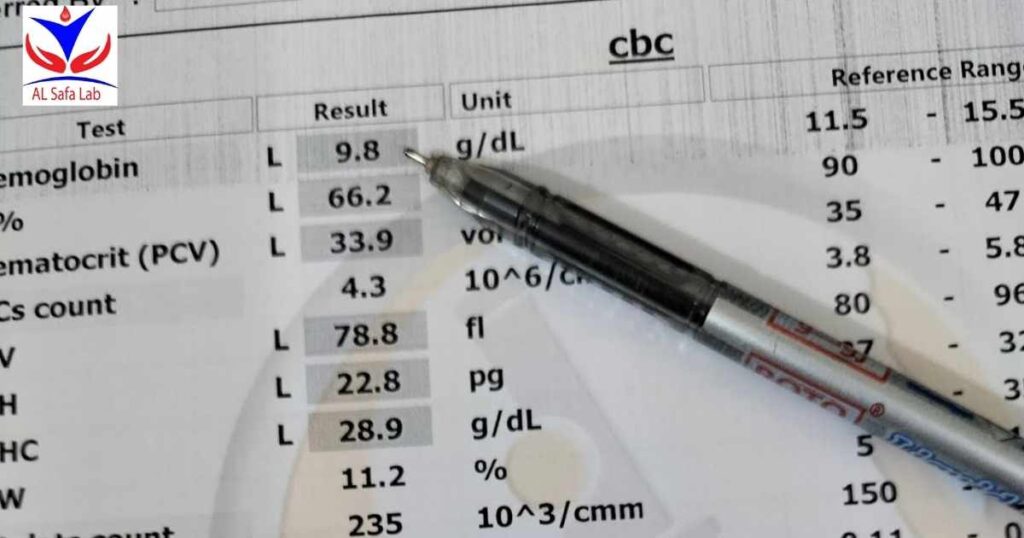 Complete Blood Count