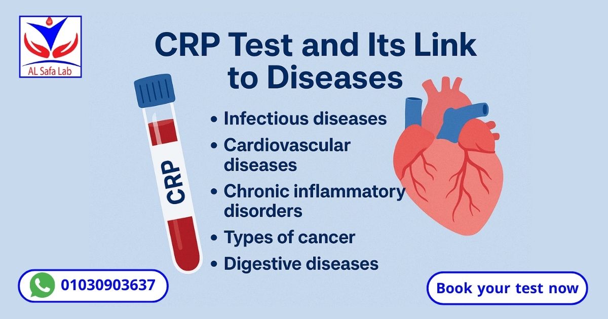 CRP Test