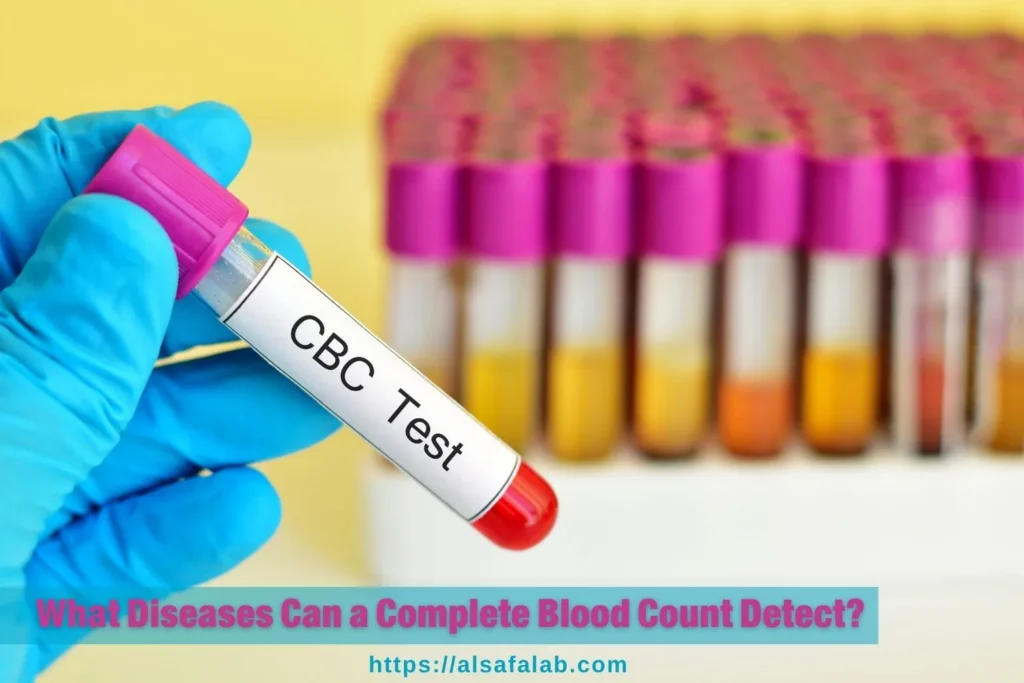 Complete Blood Count