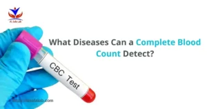 Complete Blood Count