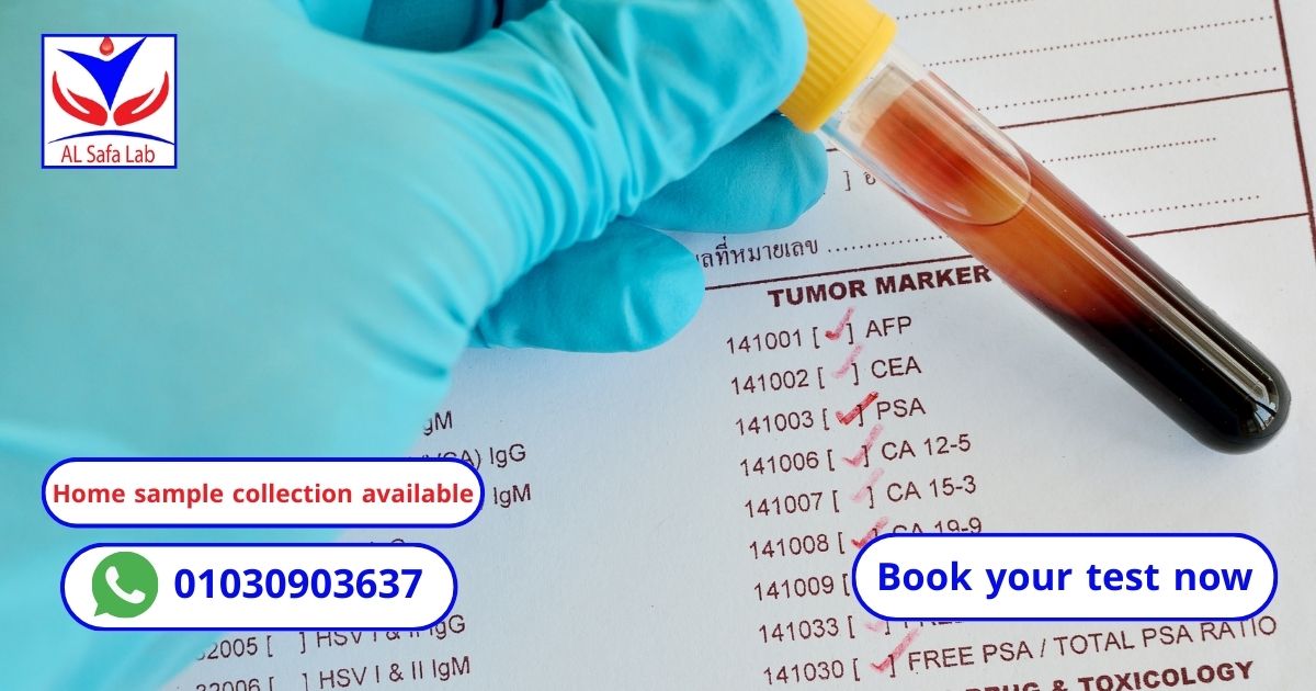 Tumor marker tests