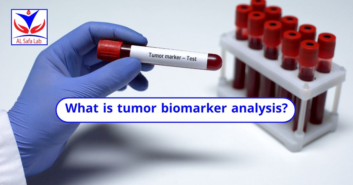 Tumor marker tests
