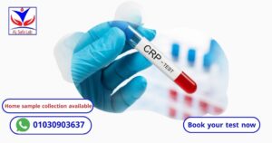 CRP Test