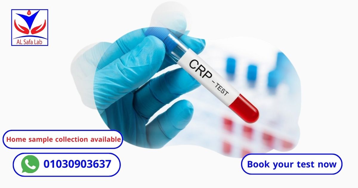 CRP Test