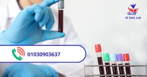 افضل معمل تحاليل في مصر