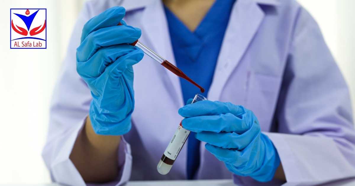 افضل معمل تحليل لإجراء فحص crp والكورونا