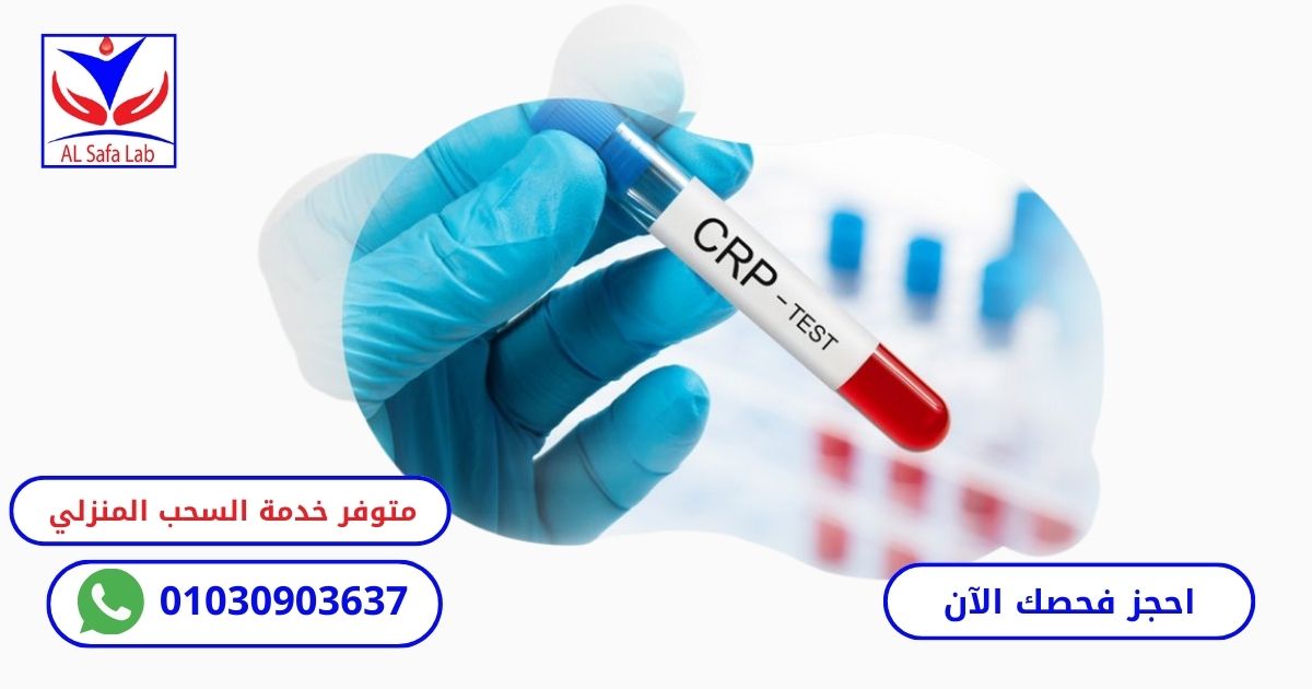 تحليل crp والكورونا