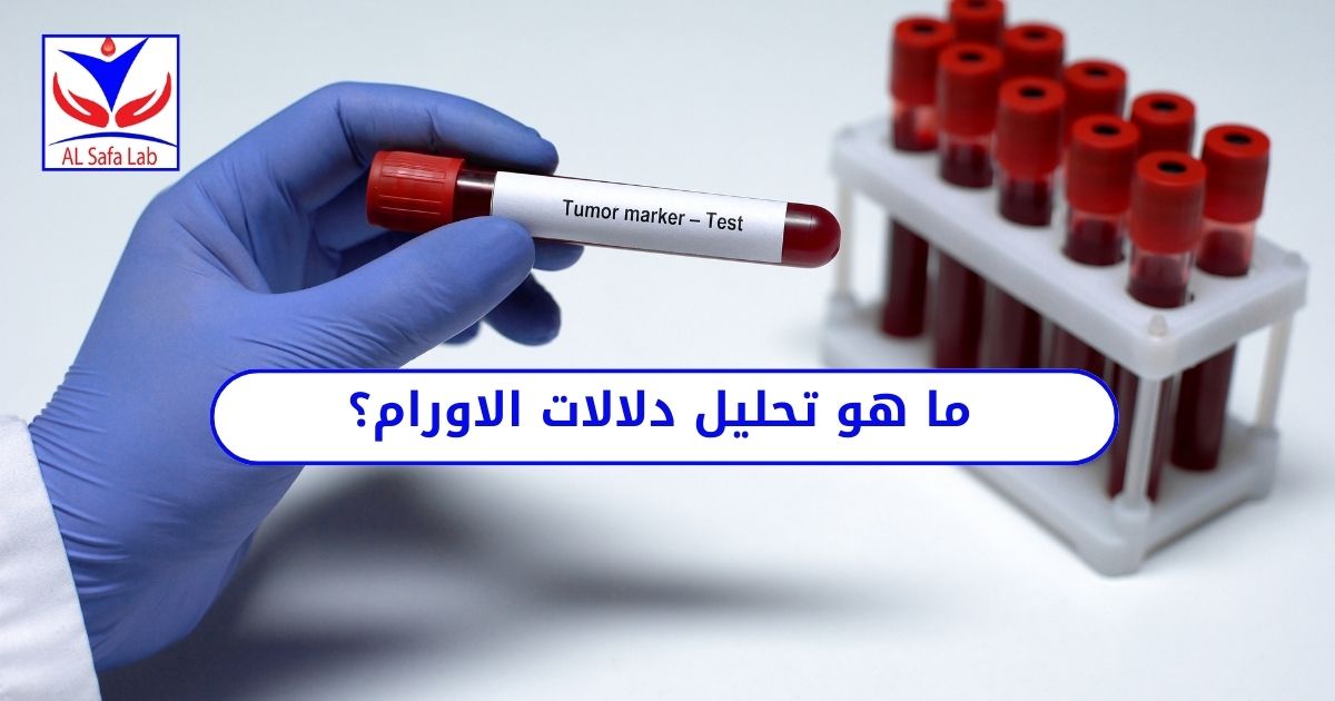 ما هو تحليل دلالات الاورام