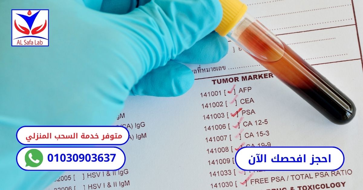 ما هو تحليل دلالات الاورام