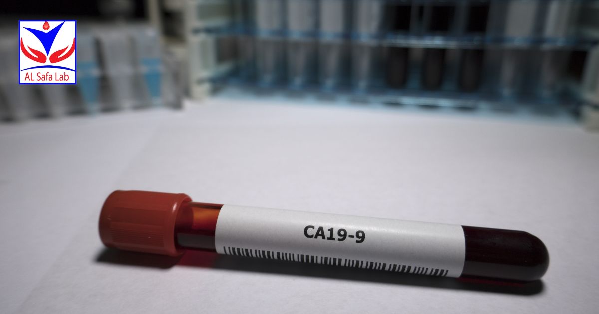 What is a Tumor Marker Test