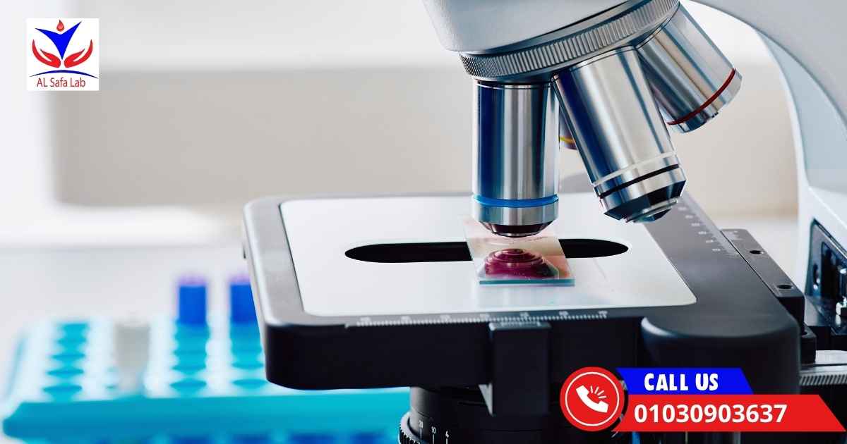 افضل معمل تحاليل في القاهرة (3)