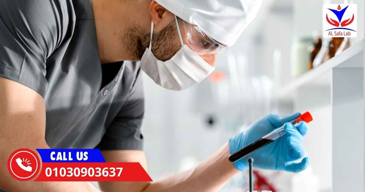 نتائج تحاليل المختبر برقم التليفون