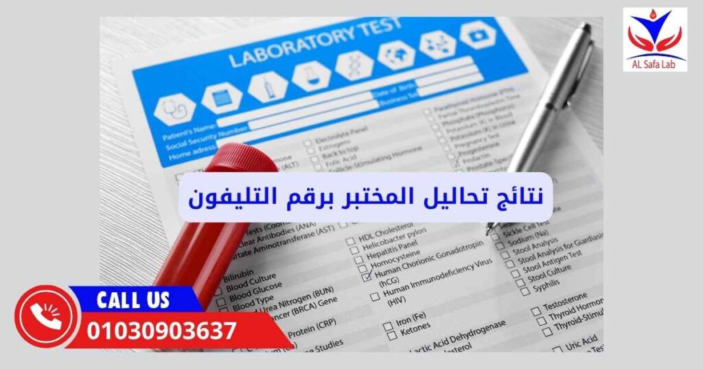 نتائج تحاليل المختبر برقم التليفون