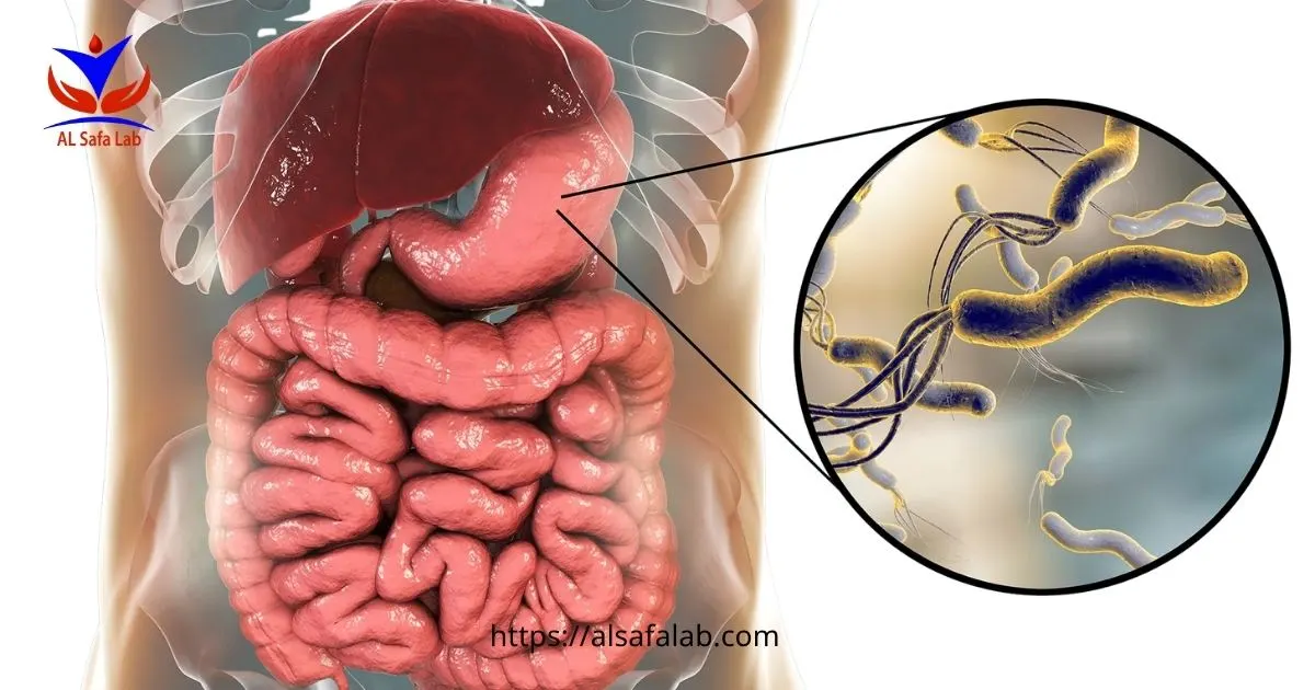 Helicobacter Pylori