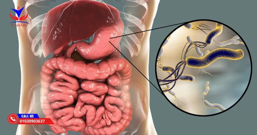 تحليل جرثومة المعدة