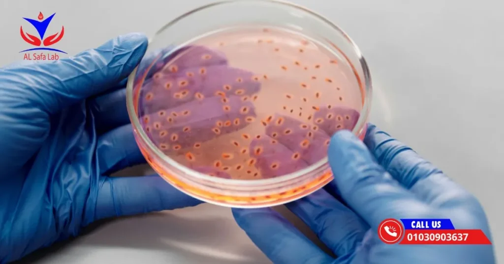 تحليل جرثومة المعدة