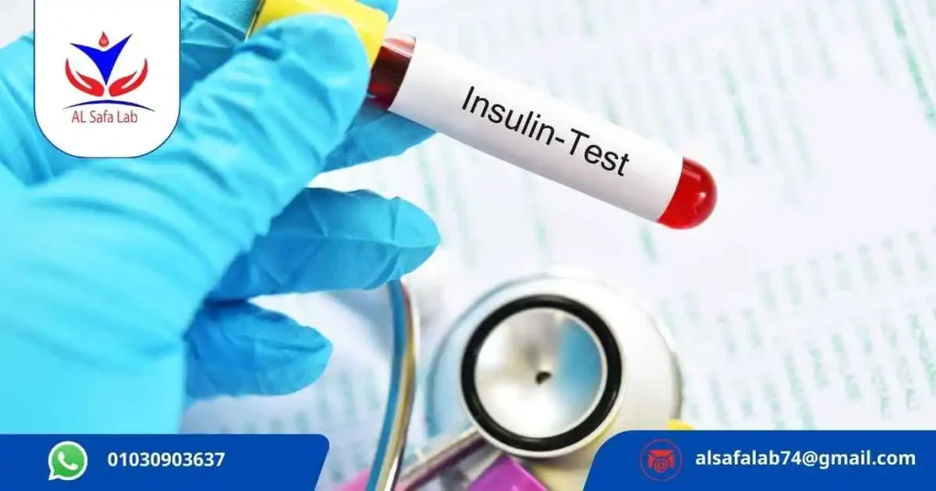 Insulin Resistance Test