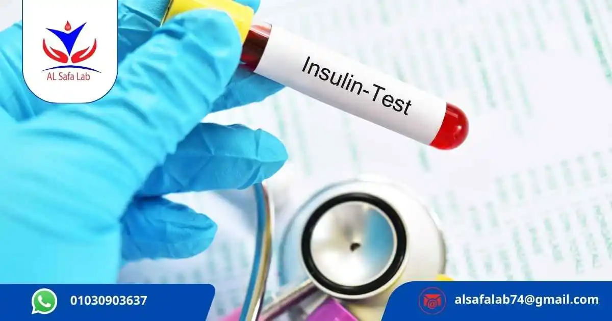 Insulin Resistance Test
