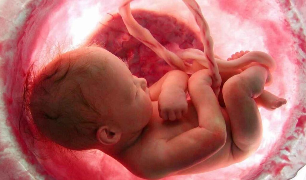 Recurrent Miscarriage Test Package