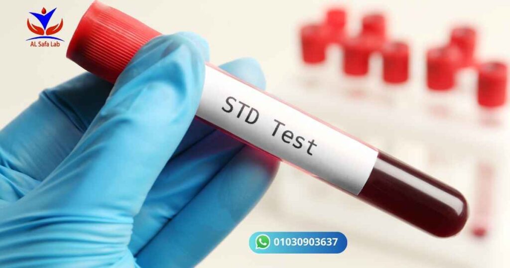 Sexually Transmitted Diseases (STDs)