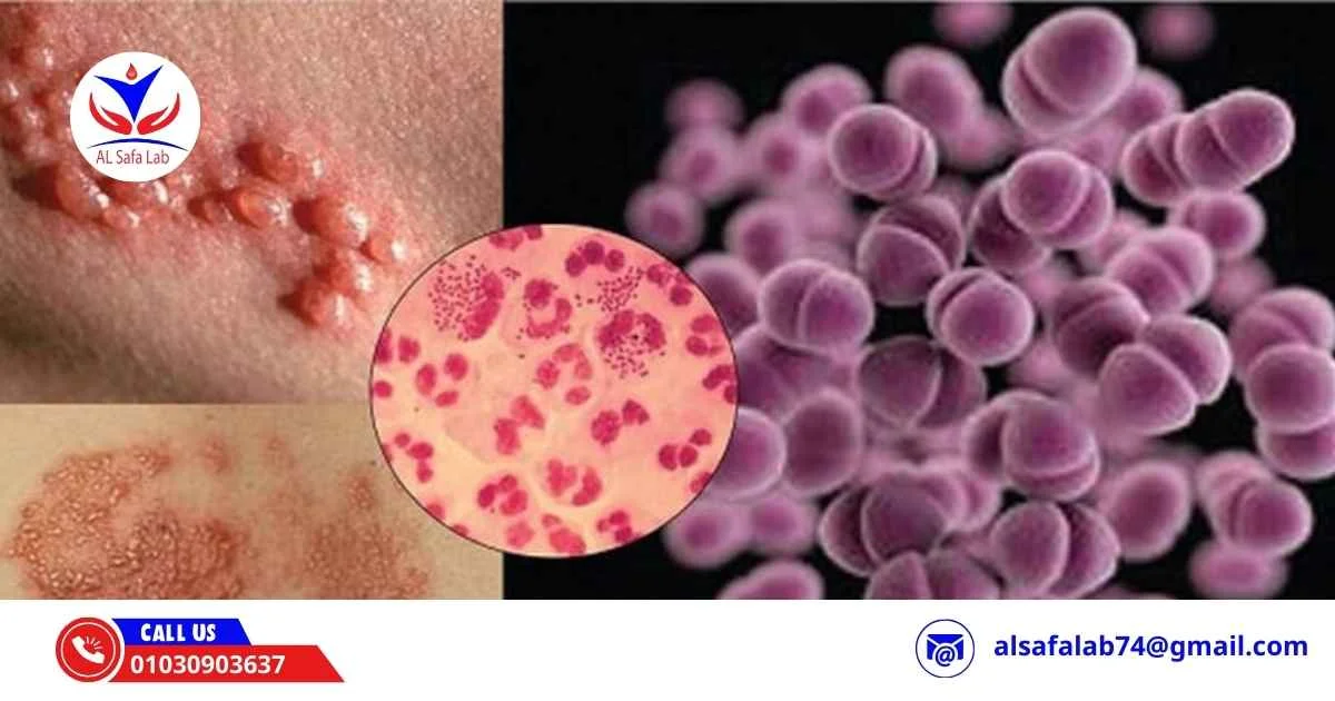 ما هي الأمراض المنقولة جنسيًا