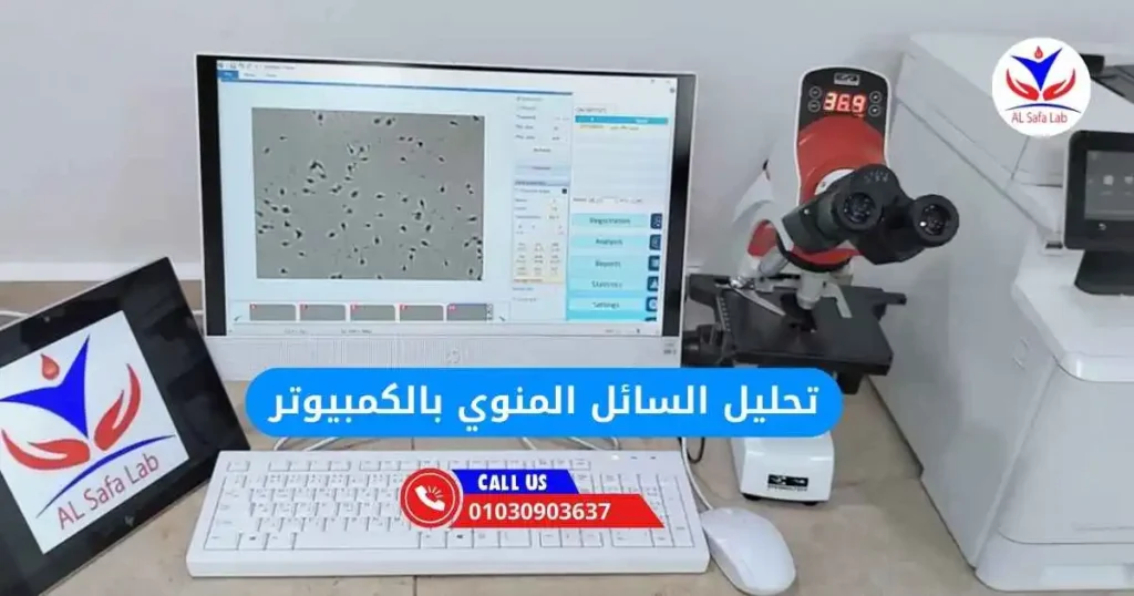 تحليل السائل المنوي بالكمبيوتر