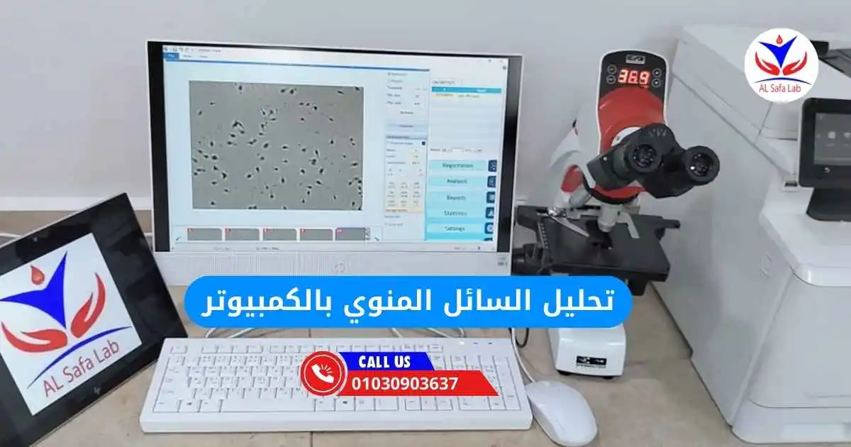 تحليل السائل المنوي بالكمبيوتر