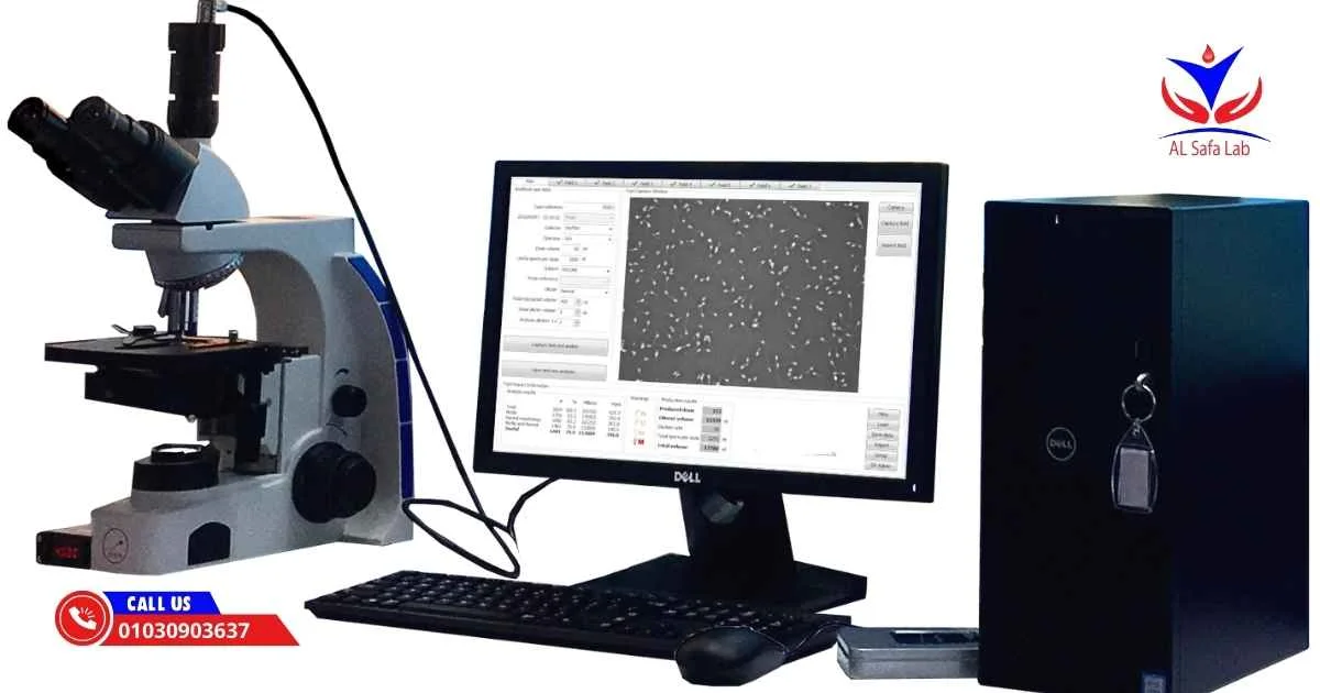 تحليل السائل المنوي بالكمبيوتر