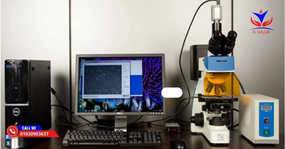 تحليل السائل المنوي بالكمبيوتر