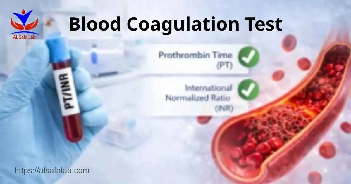 Blood Coagulation Test
