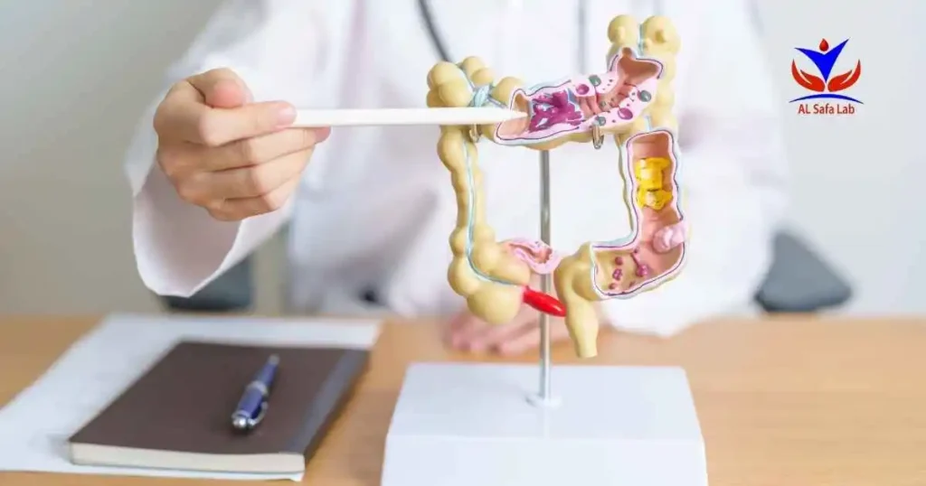 Colon Cancer Screening