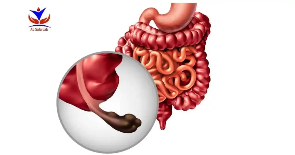 Colon Cancer Screening