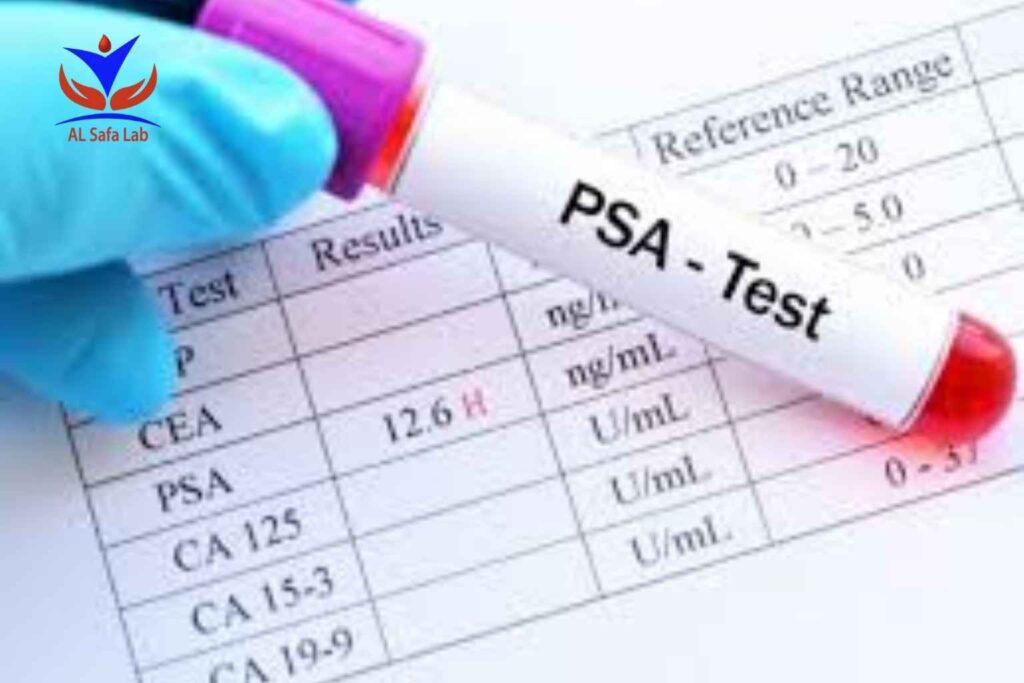 Prostate Tumor Markers