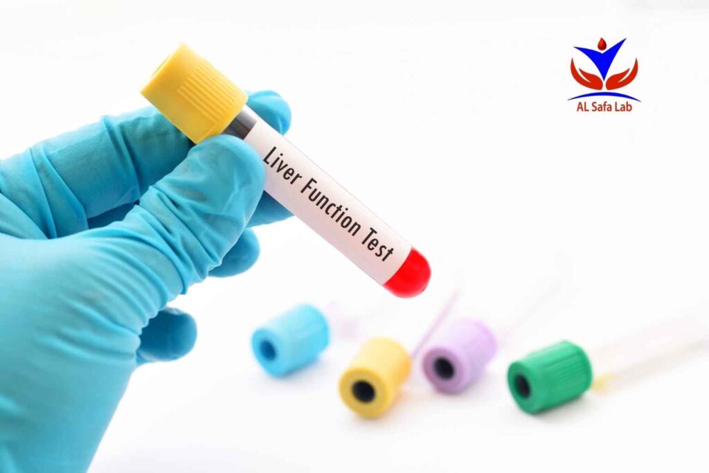 أسرع علاج لارتفاع إنزيمات الكبد