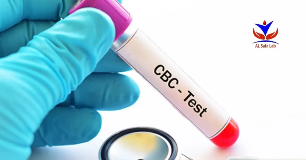تحليل cbc