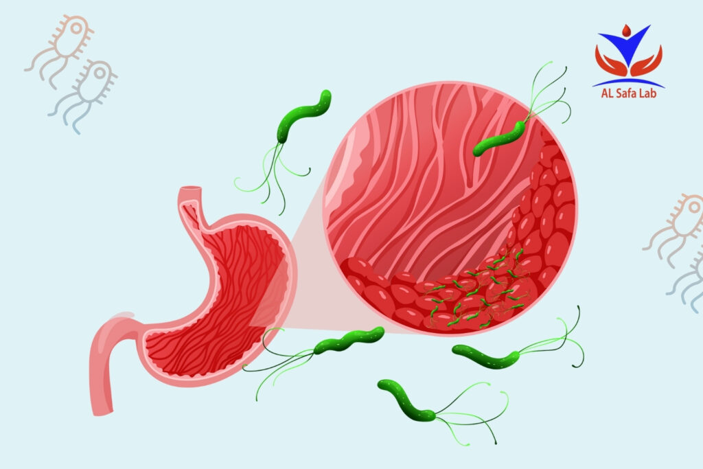 تحليل جرثومة المعدة بالتنفس 