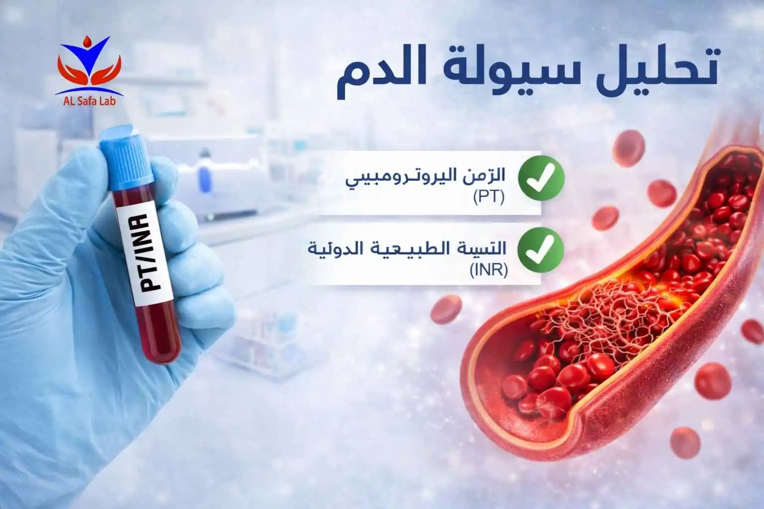 تحليل سيولة الدم