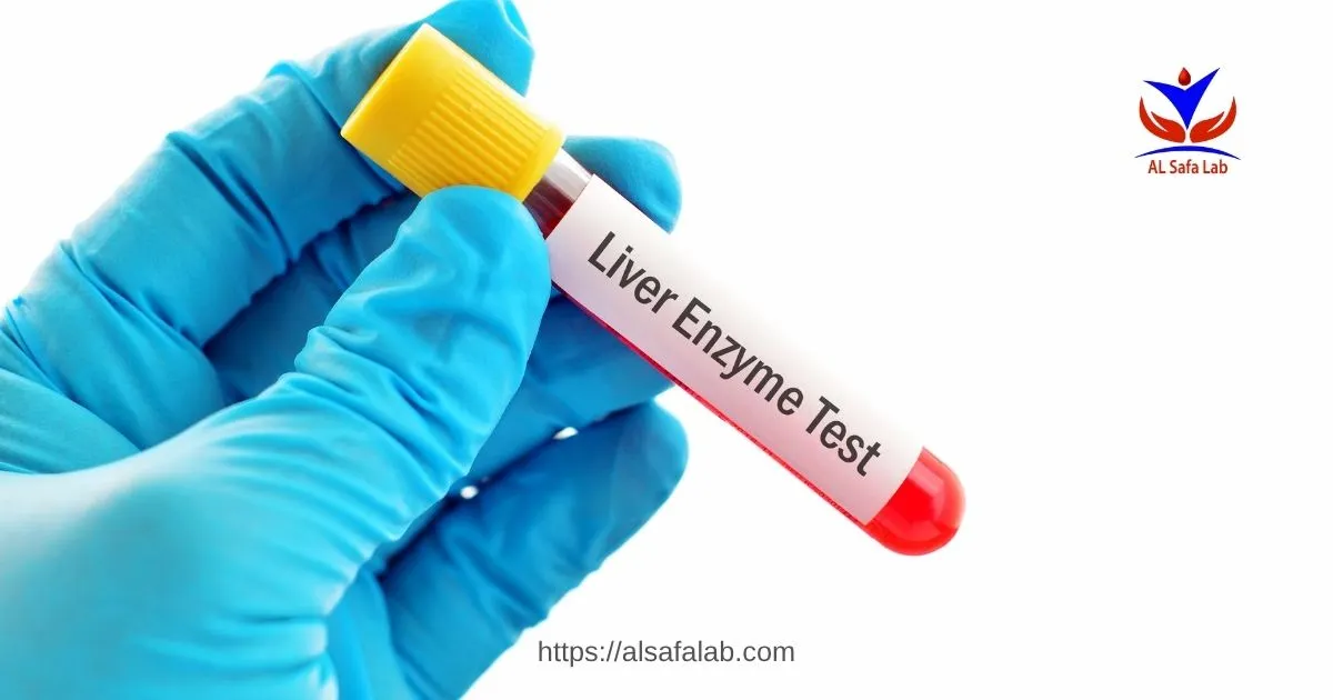 متى نقلق من ارتفاع إنزيمات الكبد