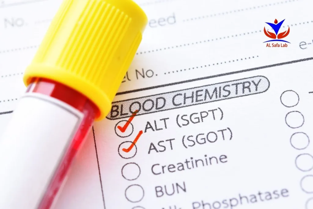 متى نقلق من ارتفاع إنزيمات الكبد