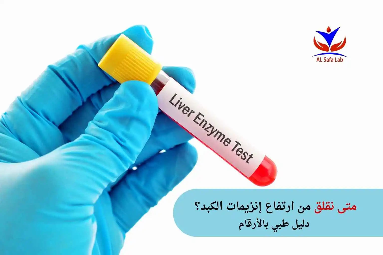متى نقلق من ارتفاع إنزيمات الكبد