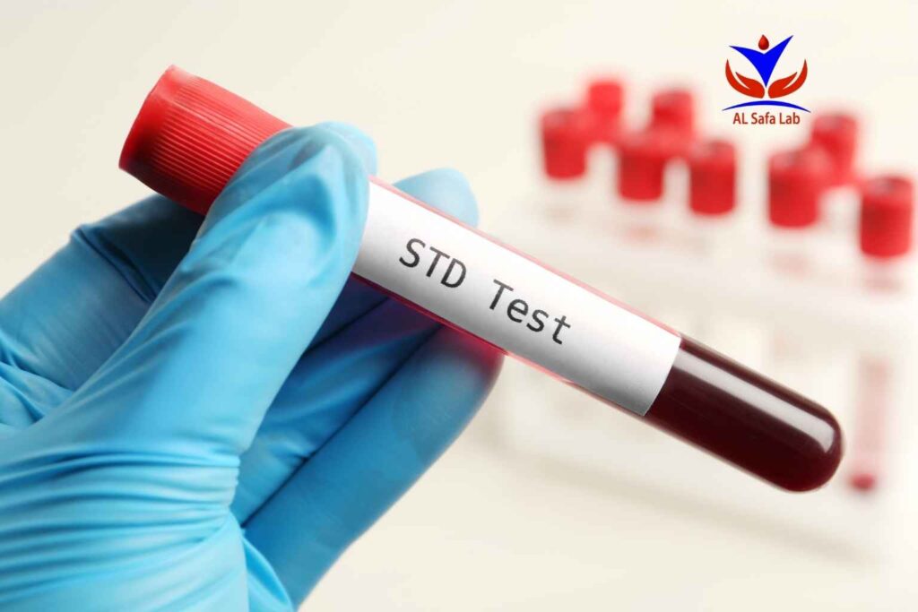 Chlamydia Test Price