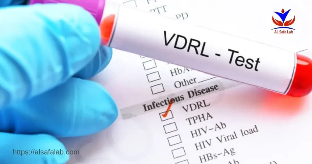 Does the VDRL test detect HIV