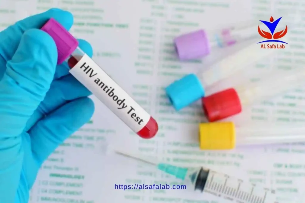 Does the VDRL test detect HIV