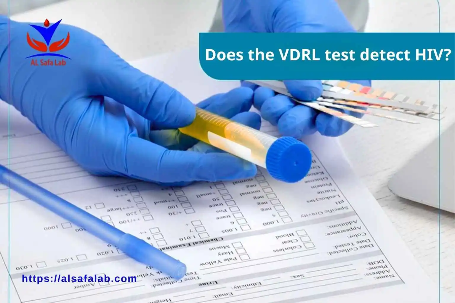 Does the VDRL test detect HIV