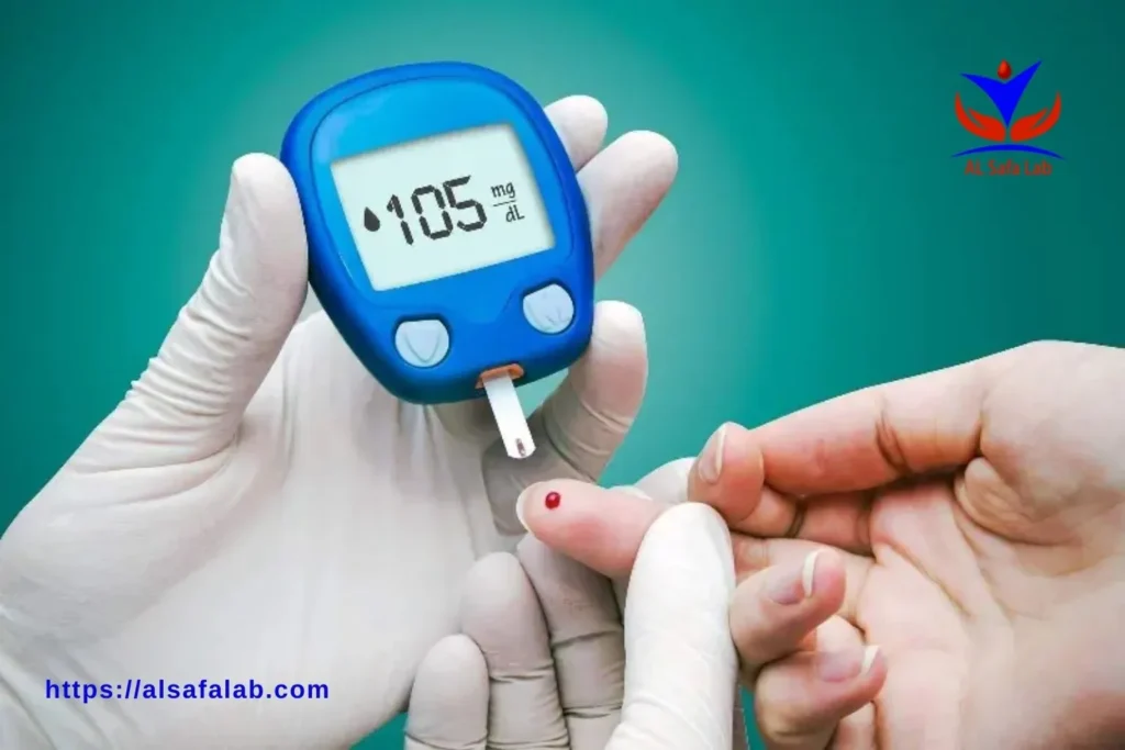 HbA1c Test
