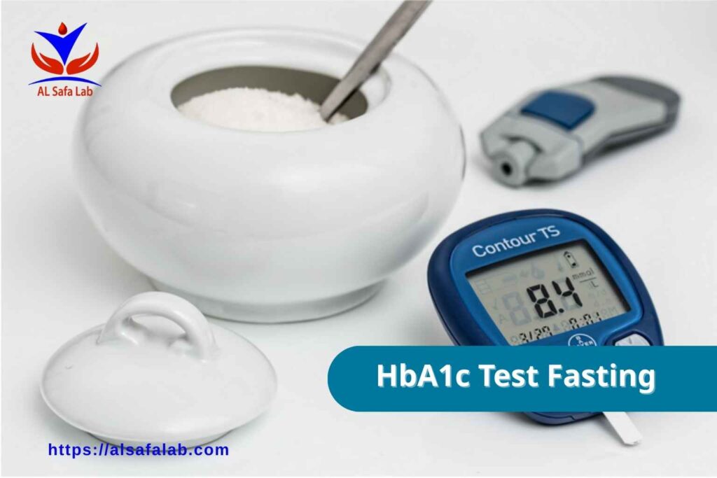 HbA1c Test Fasting