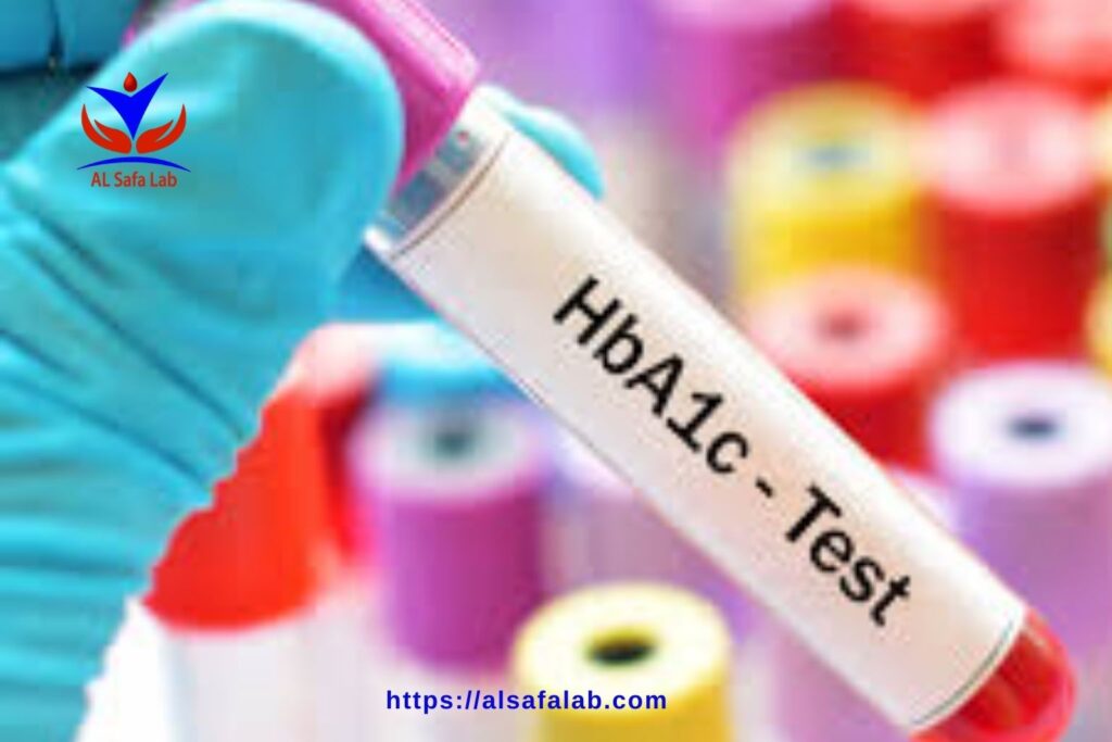 HbA1c Test Fasting