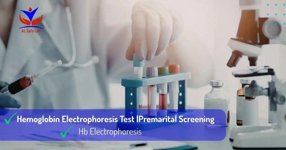 Hemoglobin Electrophoresis Test