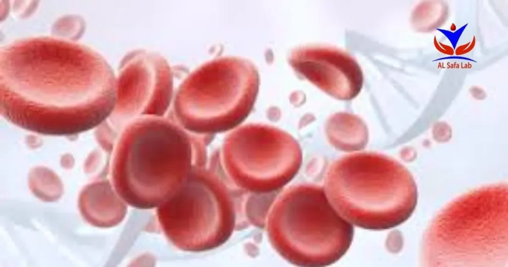 Hemoglobin Electrophoresis Test