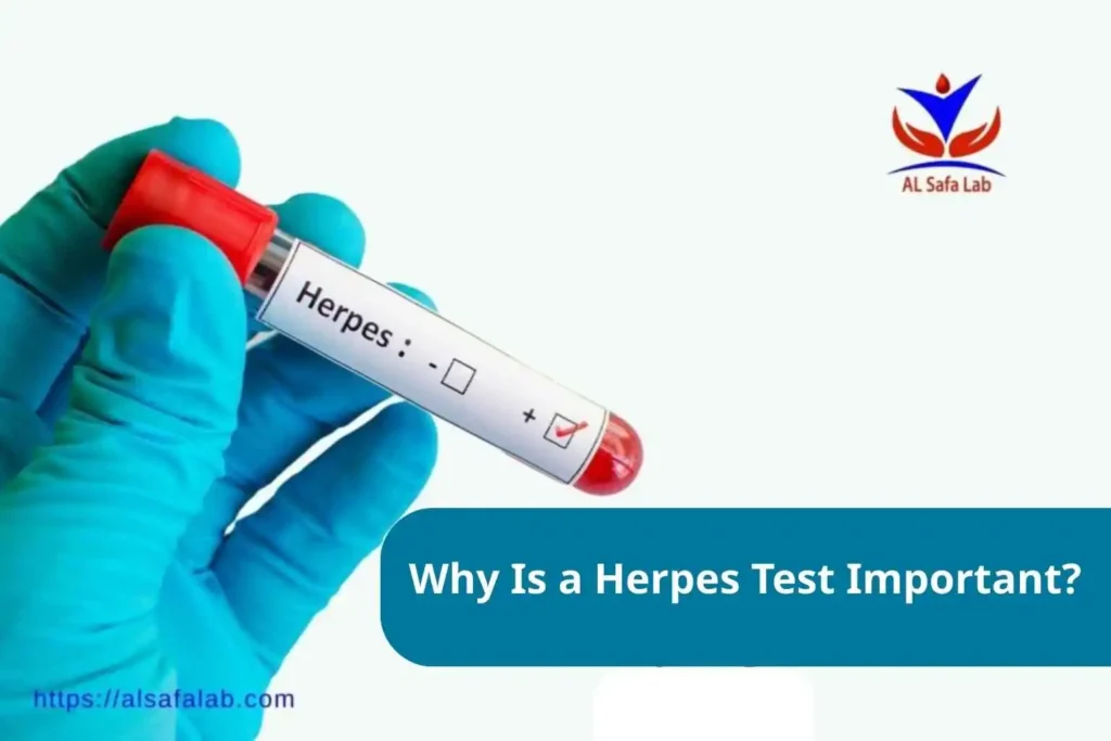Herpes Test